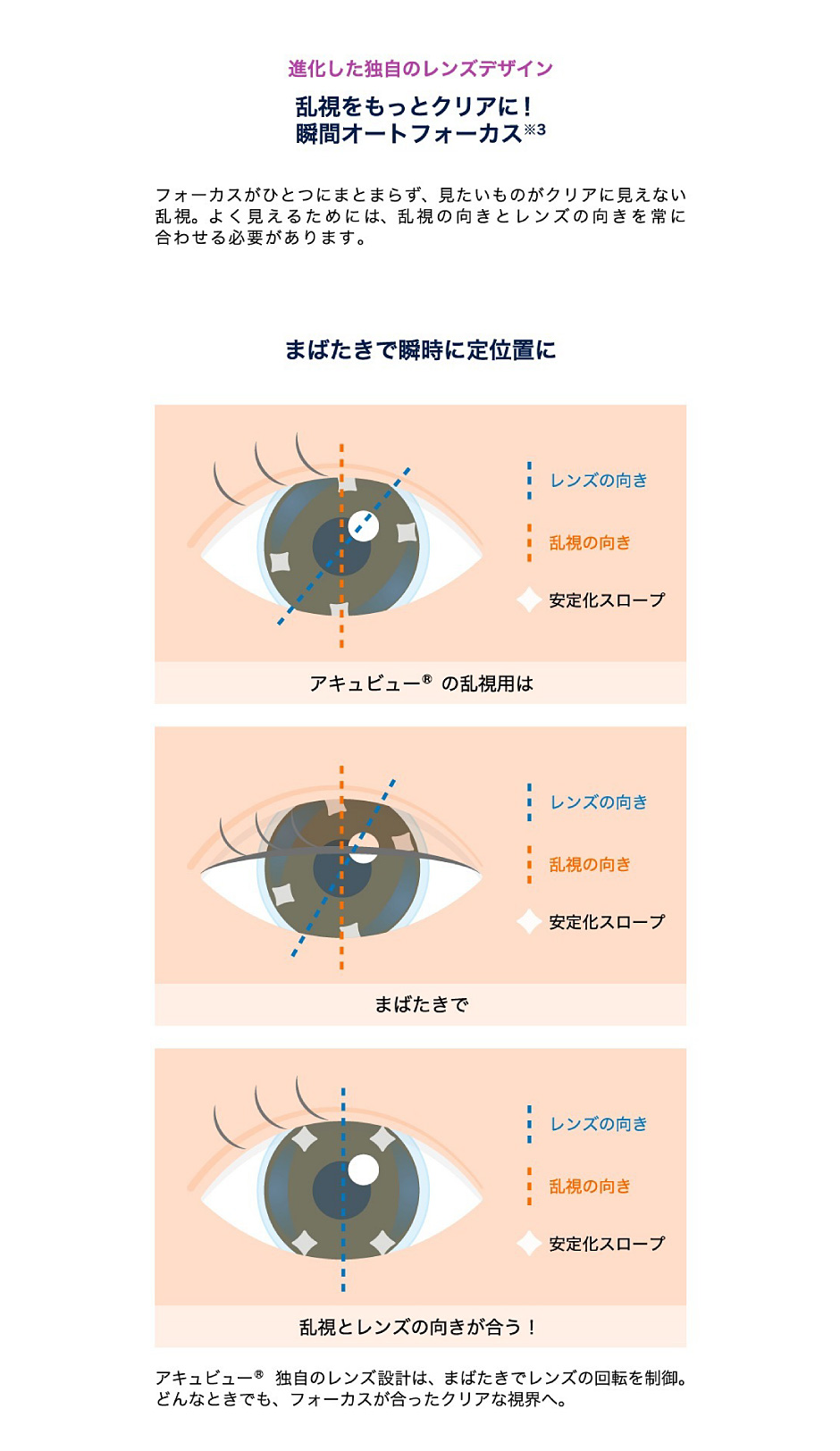 乱視をもっとクリアに！瞬間オートフォーカス